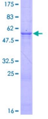 SDS-PAGE (DNASE1-2774H).jpg